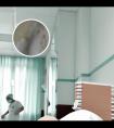 308nm光疗仪治疗