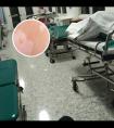308准分子疗法视频