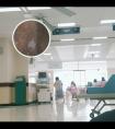 308准分子激光白癜风家用