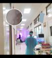 308准分子光是什么光类型