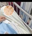 家用308激光治疗仪有效吗怎么样