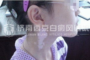 糣ƷЩ