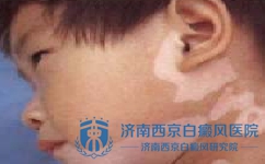 沿